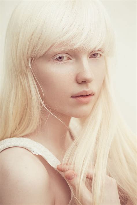 beautiful albino ladies|pretty albino girls.